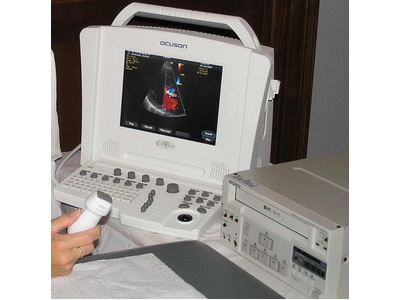 Acuson Cypress portable ultrasound